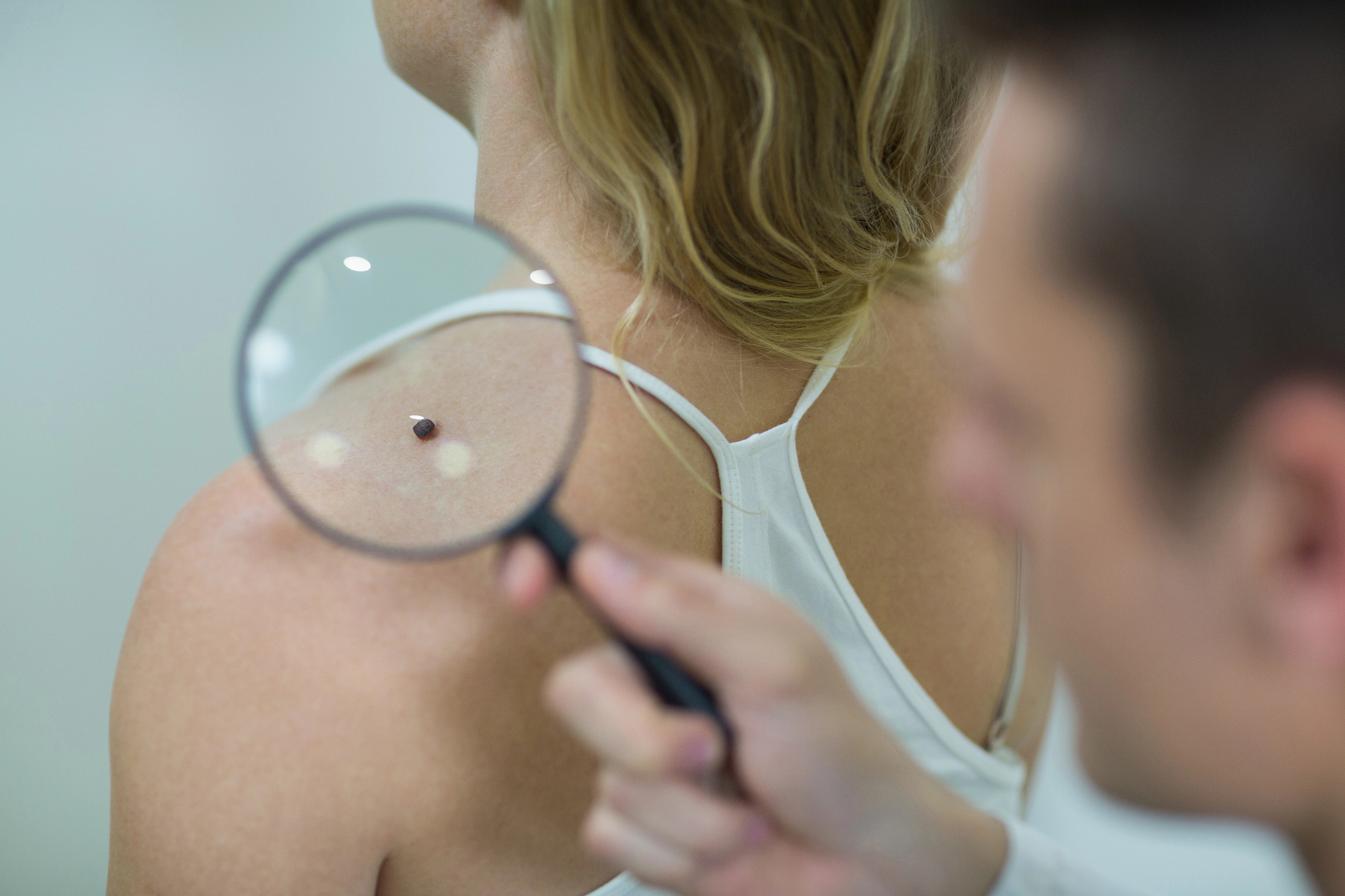 Tudi dermatologija ozavešča ljudi o bolezni kožni rak